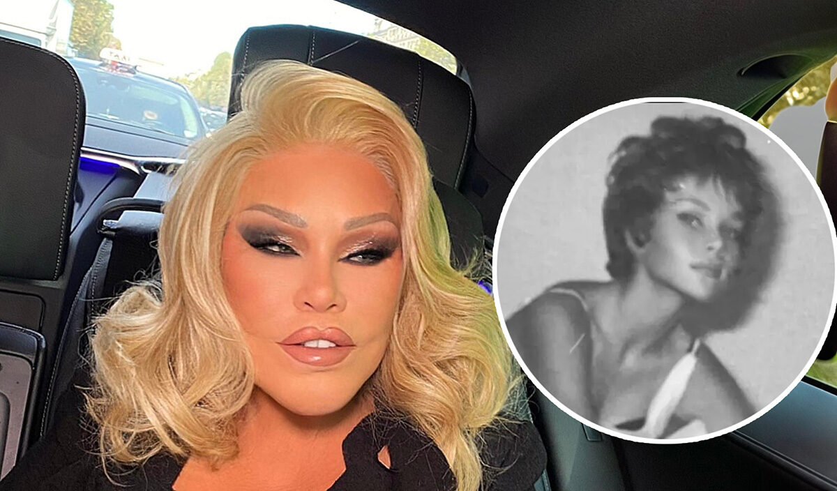 Jocelyn Wildenstein: Sosialita "Catwoman" yang Meninggalkan Jejak Kontroversial